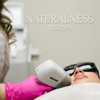 Laser skin treatment performed at Naturalness Med Spa